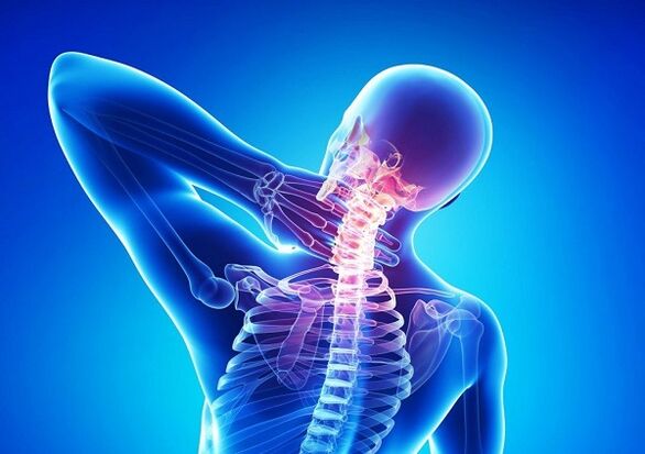 bolovi u vratnoj kralježnici s osteohondrozo
