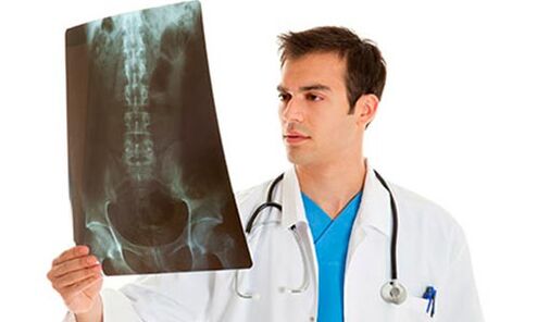 liječnik pregledava rentgen kako bi dijagnosticirao bolove u križima